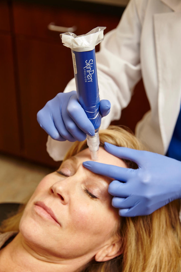 Microneedling – FDA-Cleared Treatment for Acne Scars, Wrinkles & Skin Rejuvenation