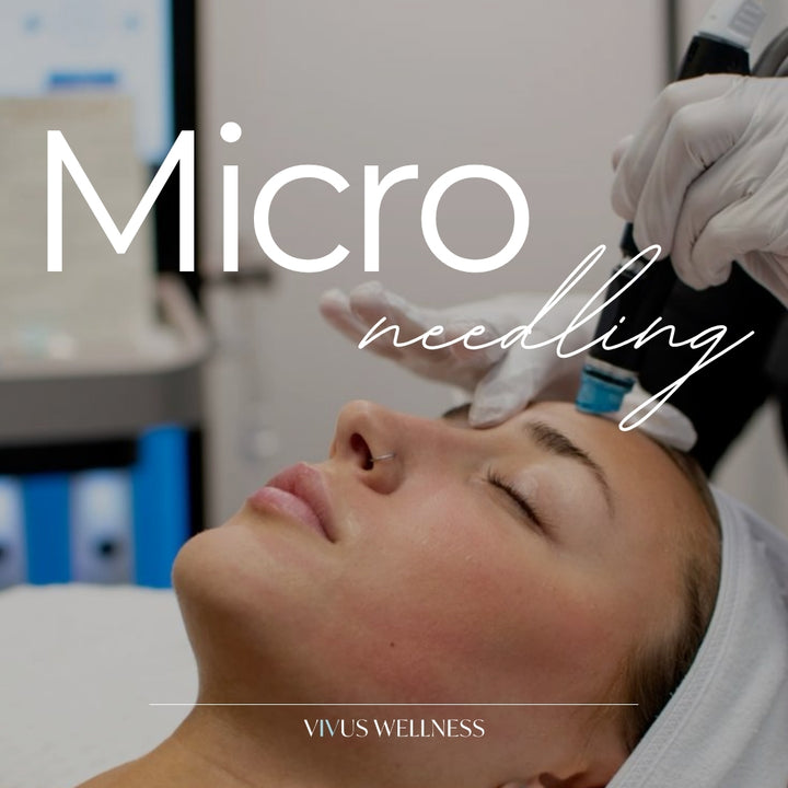 Microneedling – FDA-Cleared Treatment for Acne Scars, Wrinkles & Skin Rejuvenation